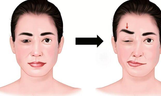 عکس/ اختلالی که سمت چپ صورت زنان بالای ۴۰سال را درگیر می کند
