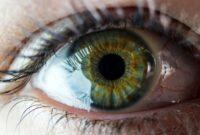 عکس/ کمیاب‌ترین «رنگ چشم» جهان چه رنگی است؟